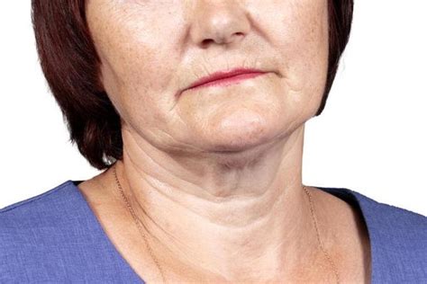 sagging skin stock  images  backgrounds