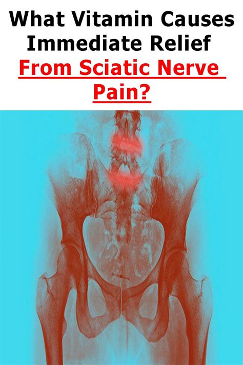 Sciatic nerve relief – Artofit