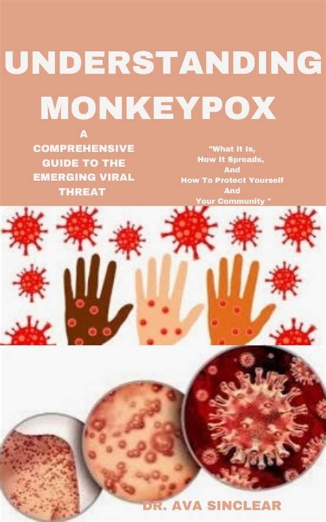 Understanding Monkeypox: A Comprehensive Guide to the Emerging Viral