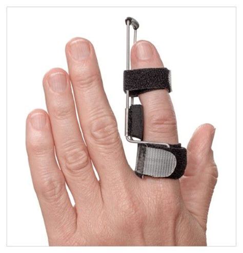 Correct DIP or PIP joint deviation with the 3pp Side Step Splint ...