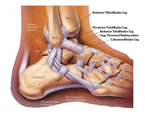 A Guide to Ankle Sprains | Hurst Podiatry