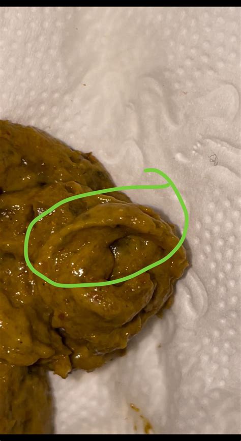 Why Is My Poop Thin Like A Pencil at Cynthia Brecht blog