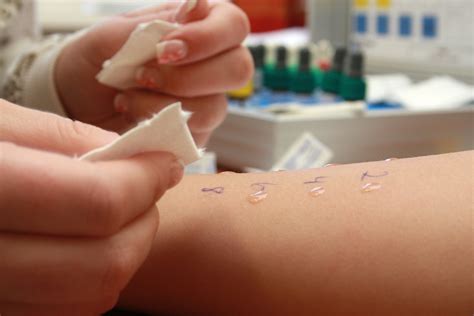 Allergy Testing — Yang Medicine