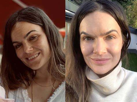 SKIN CHANGES DURING PREGNANCY - Dr. Barbara Sturm