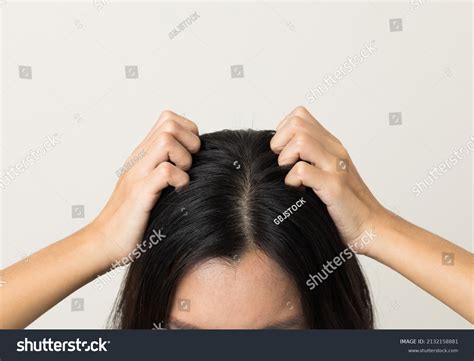 young woman itchy head  fungus stock photo  shutterstock