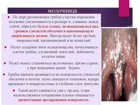 Слизистые оболочки в норме и патологии - online presentation