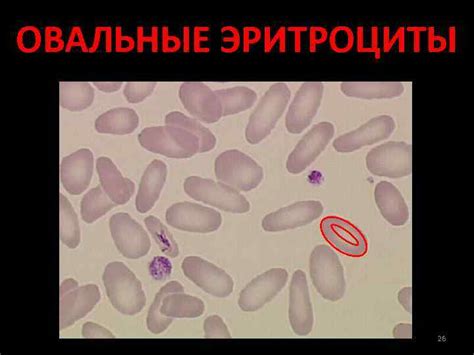 ПАТОЛОГИЯ СИСТЕМЫ КРОВИ СИСТЕМЫ ЭРИТРОЦИТОВ ЛЕКЦИЯ 2