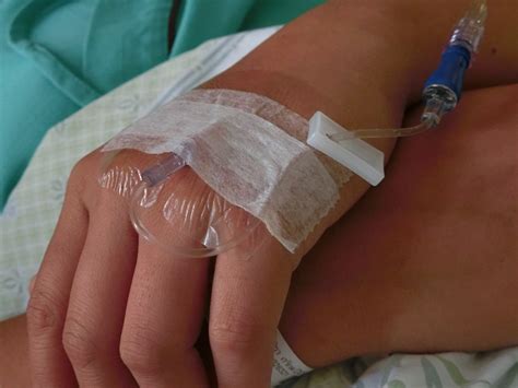 Flebitis Iv Table 2 From Measurement Of Peripheral Venous