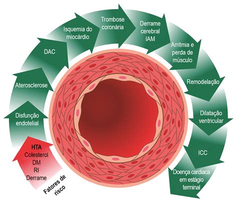 Fisiopatologia Da Hipertensão