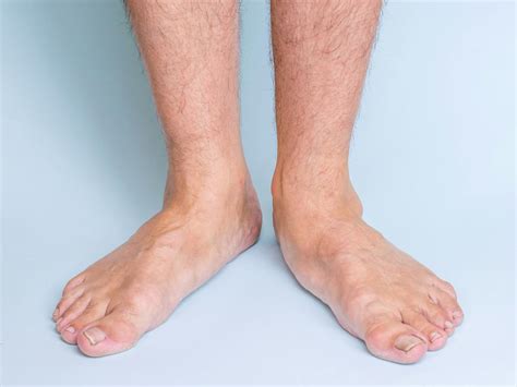 Best Shoes for Flat Feet in Adults | Podiatrist’s Guide | CLS Health