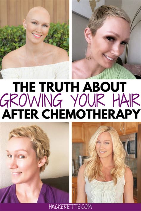 hair growth  chemo artofit