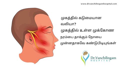 Trigeminal neuralgia எனும் முக்கிளை நரம்பைத்தாக்கி, முகத்தில் வலியை ...