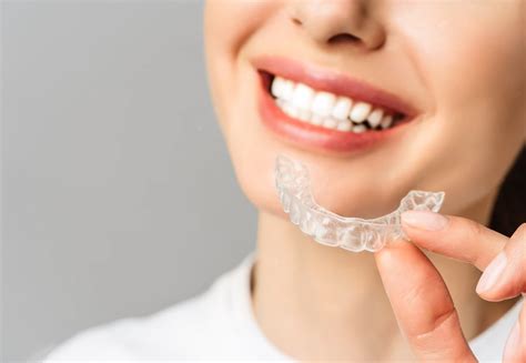 Alineadores invisibles: ¿Invisalign o Spark? - CLÍNICA DOCTOR ACEDO