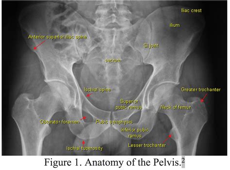 emdocsnet emergency medicine educationpelvic fractures ed