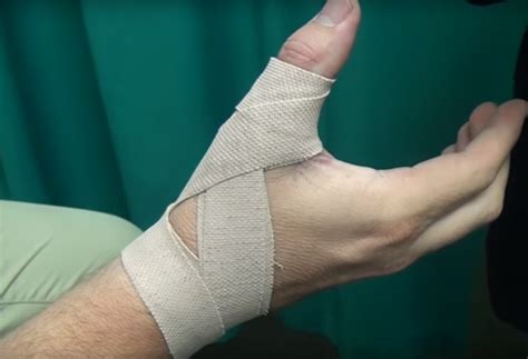 strapping jammed thumb  bryan hanes blog