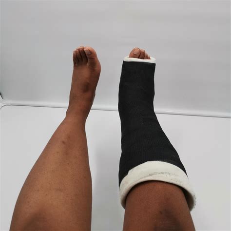 The Marvelous Misadventures of One Lady's Flat feet, double