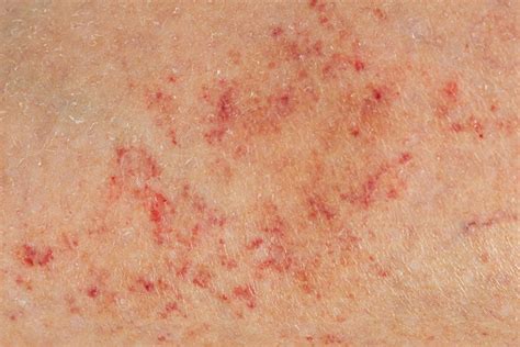 red dots  skin rash