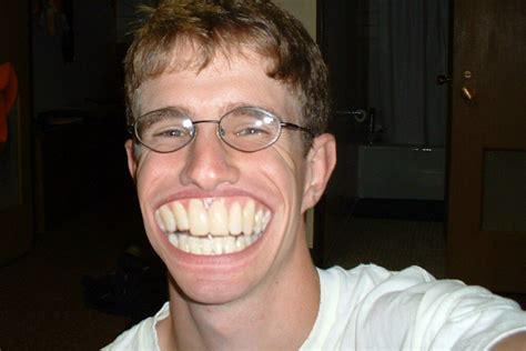 psbattle guy  big teeth rphotoshopbattles