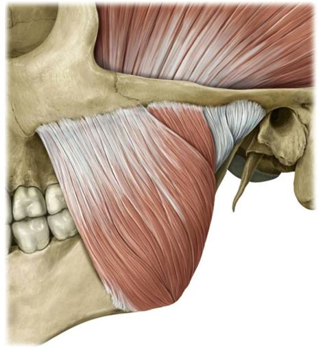 masseter muscle web dmd