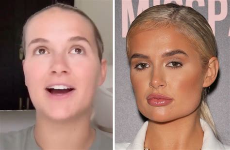 Molly-Mae Hague celebrates almost five years without filler following ...