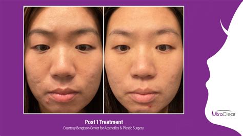 levisa lazer: Before & After Photos That Will Amaze You - r7c0353