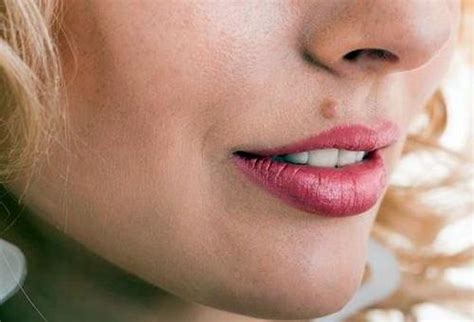 Папилломовирусная инфекция: симптомы и диагностика | Health & Beauty | Дзен
