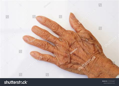 missing fingers  white background stock photo  shutterstock