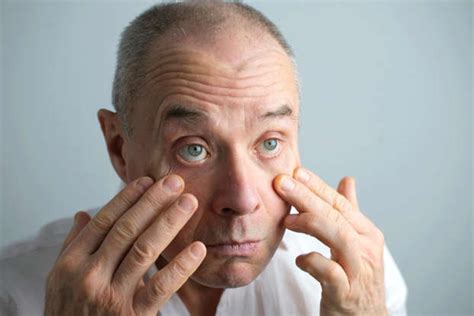 haemolacria  condition    real dracula cry tears  blood