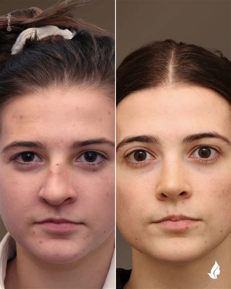 Midwest Facial Plastic Surgery & Face Cosmetic Skincare | Woodbury MN