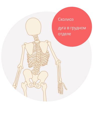 3D коррекция сколиоза по методу К.Шрот. Что это?