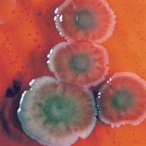 pseudomonas  unwelcome visitor   surgical case