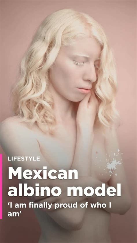 Mexican albino model is changing beauty standards