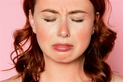 ways  treat  sunburn