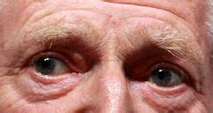 categorydoctor  eyes wikimedia commons
