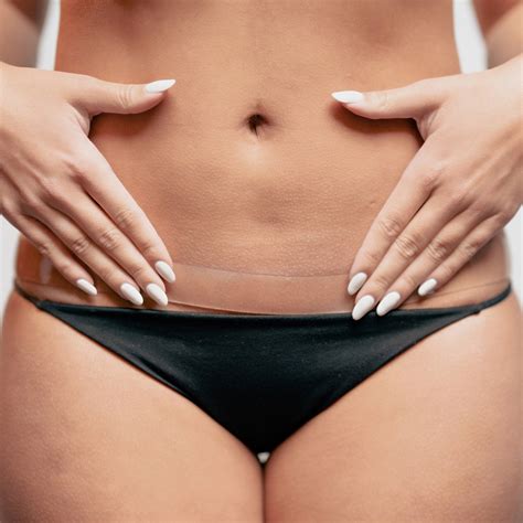 Why Does My Scar Itch? Understanding Itchy Scars and Finding Relief