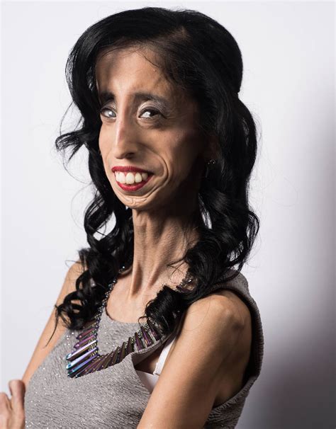 'Online bullies called me the world's ugliest woman' - Lizzie Velasquez