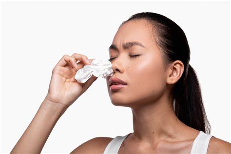 nosebleed        entails