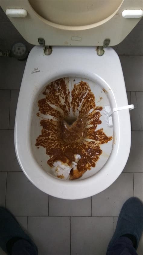 My diarrhea : r/poop