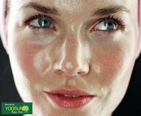 da dau la gi da dau nen dung gi cach cham soc da dau mun nhon