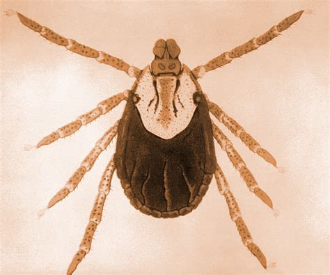 Rocky Mountain Spotted Fever Microscopic