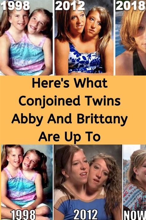 Here's What Conjoined Twins Abby And Brittany Are Up To | Famous twins, Conjoined twins, Twin ...