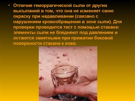 Менингококковая инфекция - презентация онлайн