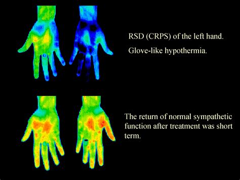What is Thermal Imaging? — Gaston Thermal Imaging, Inc.