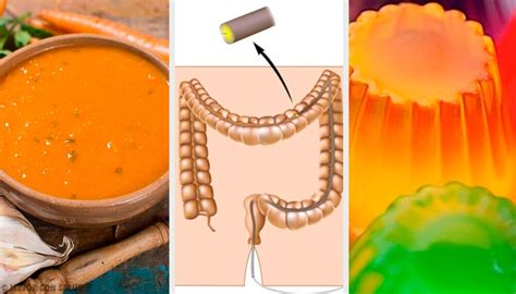 Colonoscopia O Que Pode Comer - Dieta Para Colonoscopia: Todo Lo Que Necesitas Saber – Estrich Mobil