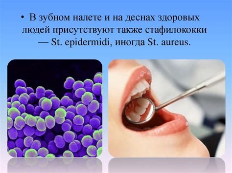 Микрофлора полости рта. Микробиология - презентация онлайн