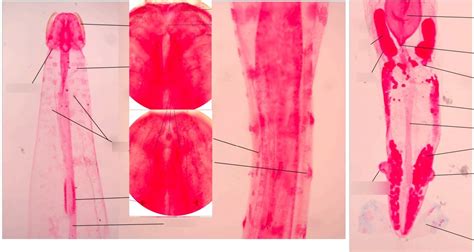 chaetognatha total diagram quizlet