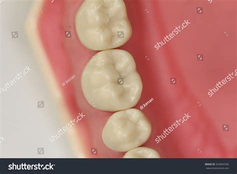 occlusal view  premolar molar teeth stock photo edit
