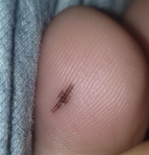 This mole on the bottom of my pinky toe that kinda looks like an old