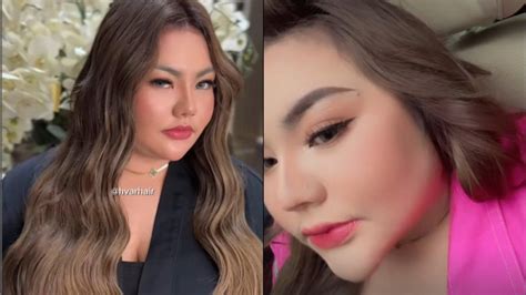Ngebet Langsing, Lisa Mariana Konsul Dokter untuk Operasi Bariatrik ...