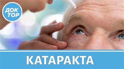 Симптомы катаракты. Возможно ли лечение катаракты без операции? - YouTube
